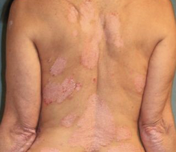 Patient baseline back image